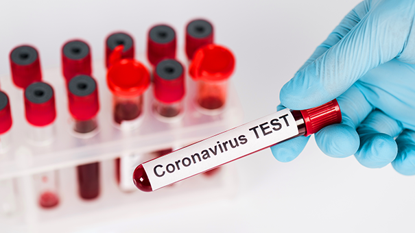 Срок лабораторного исследования на коронавирус ограничат сутками