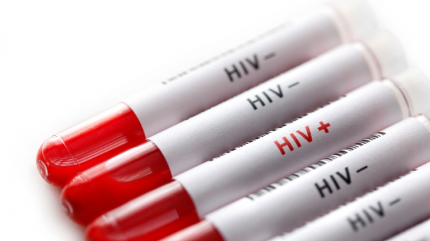 Правительство утвердило порядок ведения реестра больных ВИЧ и туберкулезом