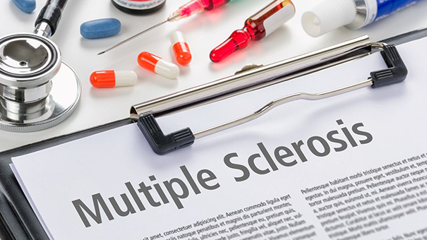 Стандарт медпомощи при рассеянном склерозе: препараты и дозировки