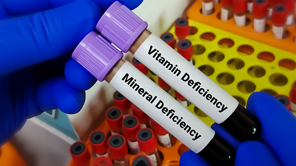 Лекарства VS витамины