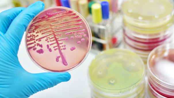 Ученые научились определять устойчивость бактерий к антибиотикам за 10 минут