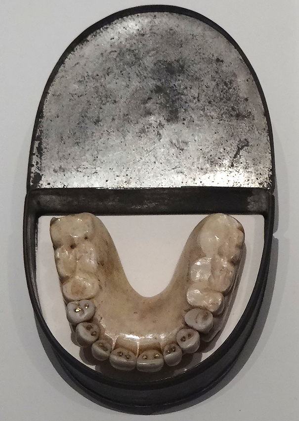 Dentures_with_Waterloo_Teeth_-_Military_Museum_-_Dresden_-_Germany_crop.png