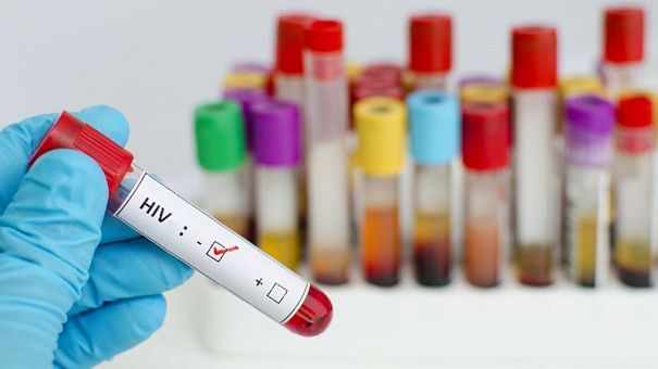 Госфинансирование препаратов для ВИЧ-инфицированных резко сократилось на фоне роста числа заболевших