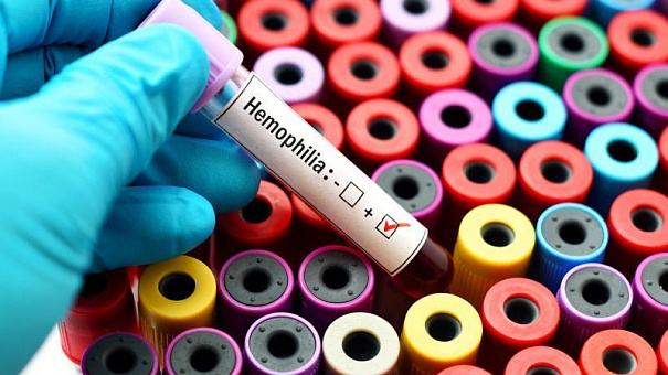 FDA одобрило препарат Alhemo для лечения гемофилии