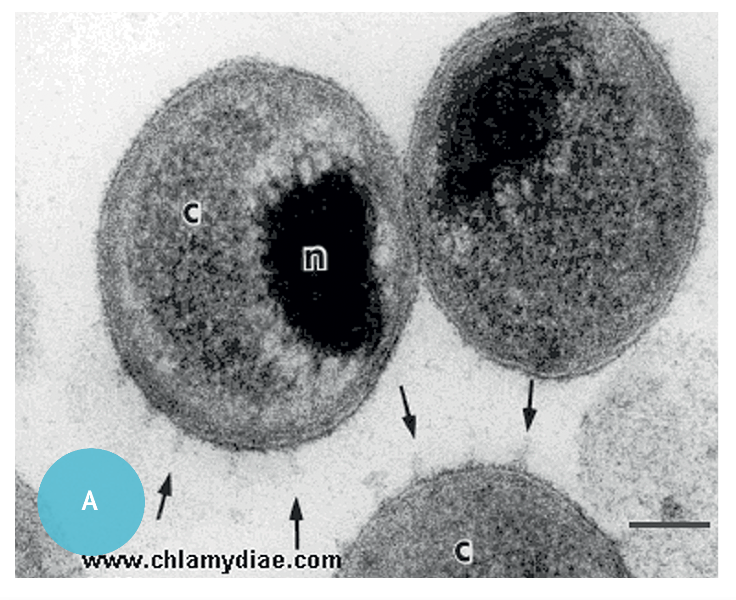Откуда берутся хламидии. Хламидии под микроскопом. Элементарные и ретикулярные тельца хламидий. Этиология хламидийных инфекций.