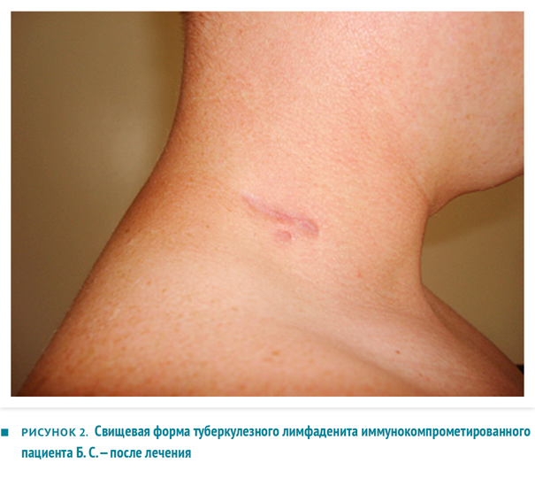 vrach_2016_04_клинический-случай_02.png